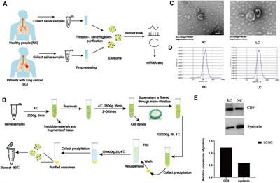 Comparative analyses of salivary exosomal miRNAs for patients with or without lung cancer